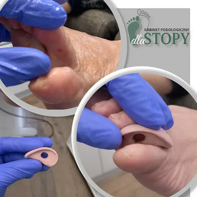 Gabinet Podologiczny Dla Stopy mgr Marta Zdobylak